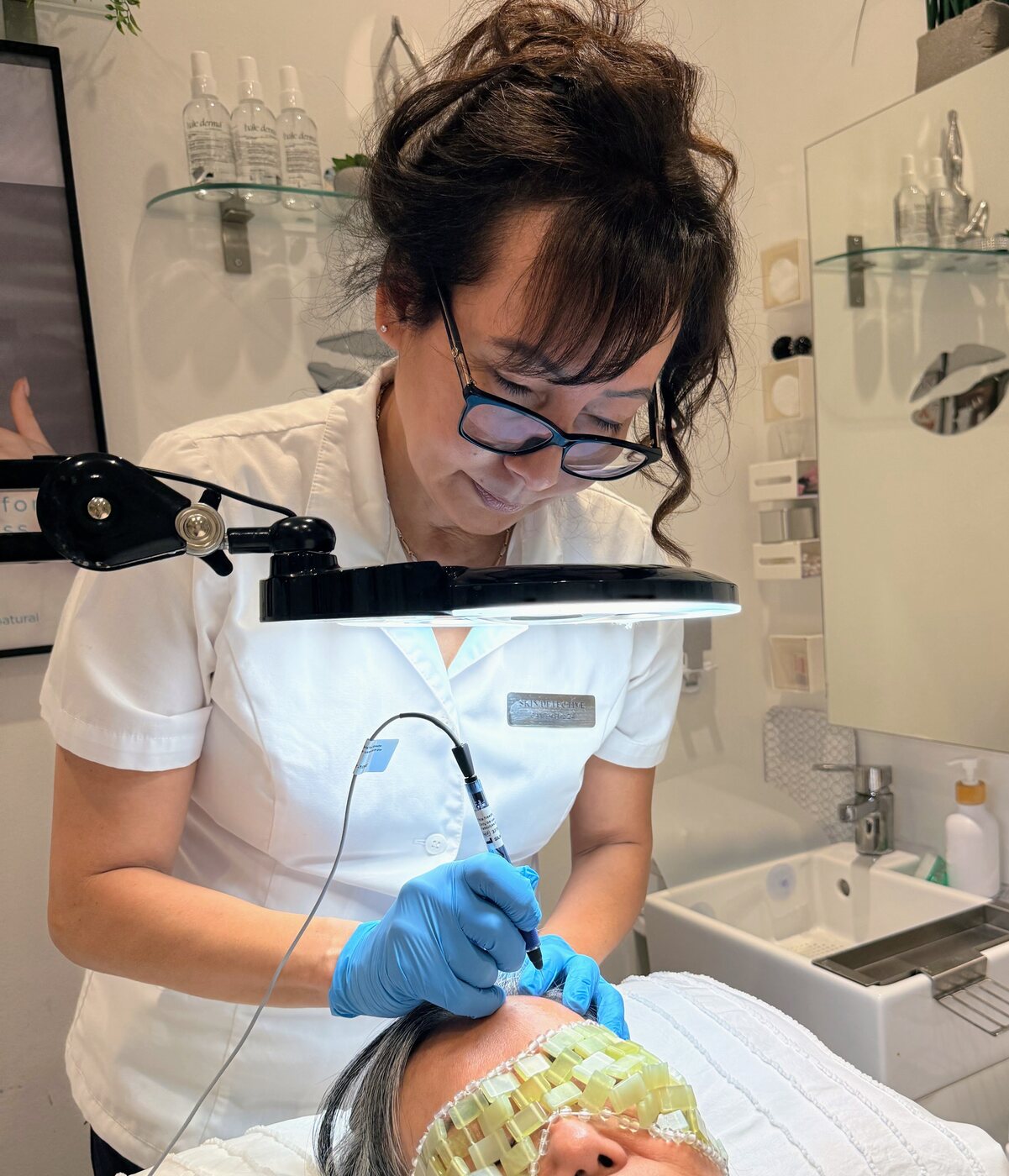 Precision thermocoagulation skin tag removal in Surrey BC